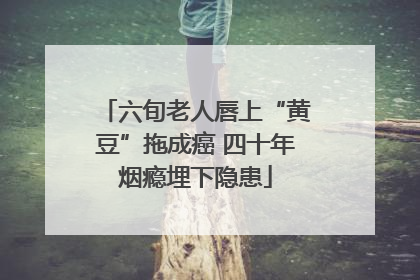 六旬老人唇上“黄豆”拖成癌 四十年烟瘾埋下隐患